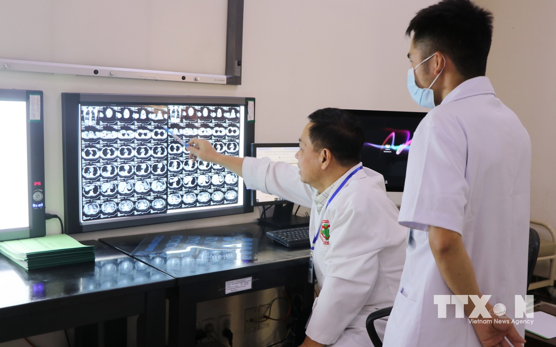Từ kết quả chụp CT, bác sĩ sẽ nhìn rõ và tìm ra nguyên nhân và có hướng điều trị sớm cho bệnh nhân. (Ảnh: Lê Xuân/TTXVN)